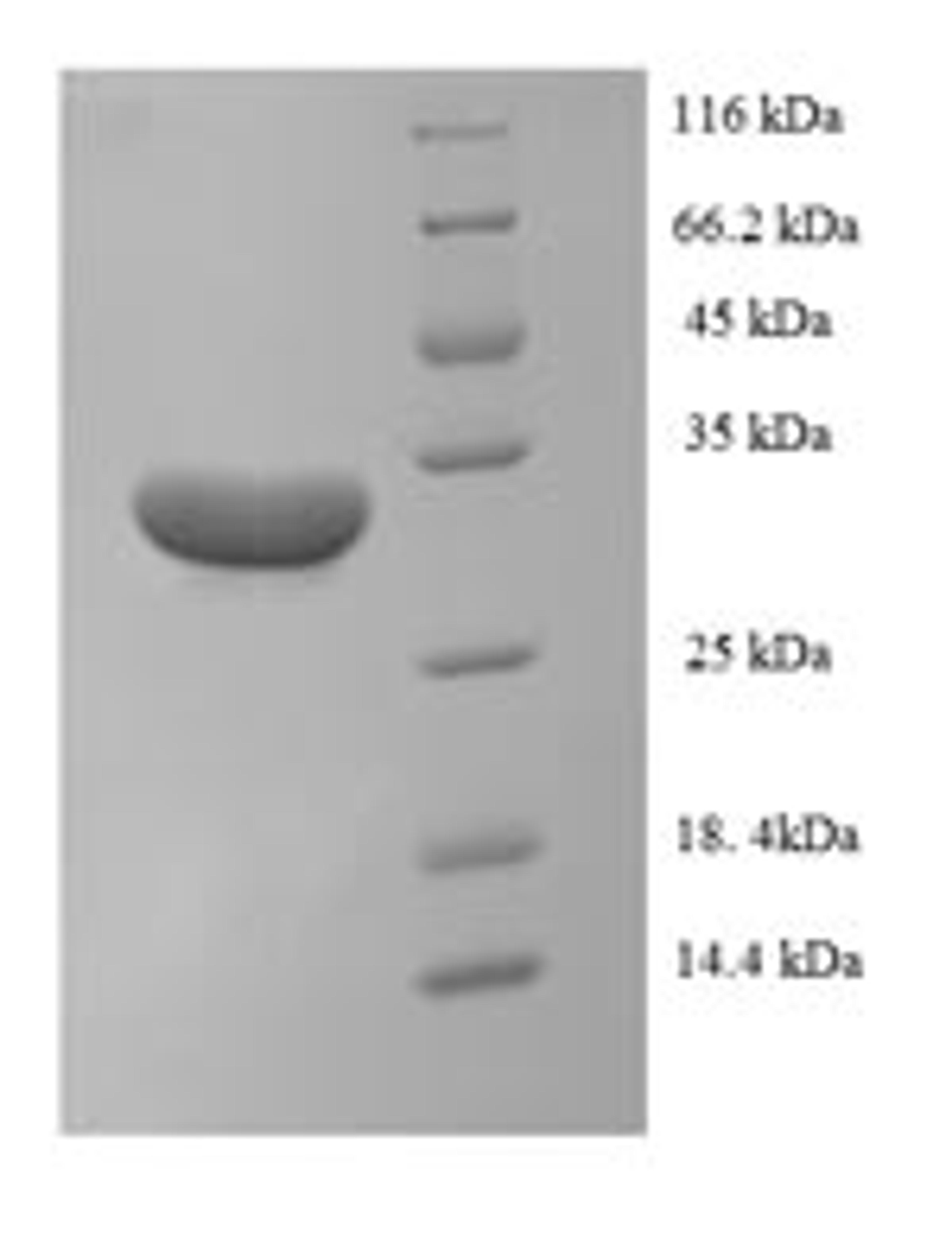 (Tris-Glycine gel) Discontinuous SDS-PAGE (reduced) with 5% enrichment gel and 15% separation gel.