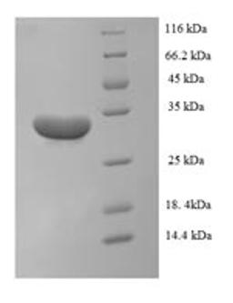 (Tris-Glycine gel) Discontinuous SDS-PAGE (reduced) with 5% enrichment gel and 15% separation gel.