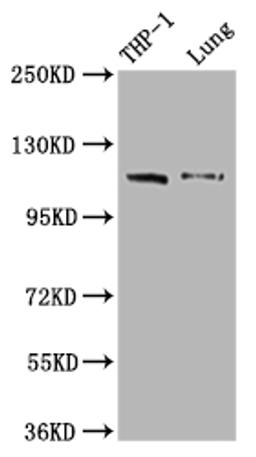Western Blot. Positive WB detected in: THP-1 whole cell lysate, Mouse lung tissue. All lanes: MDA5 antibody at 1:2000. Secondary. Goat polyclonal to rabbit IgG at 1/50000 dilution. Predicted band size: 117, 26 kDa. Observed band size: 117 kDa. 