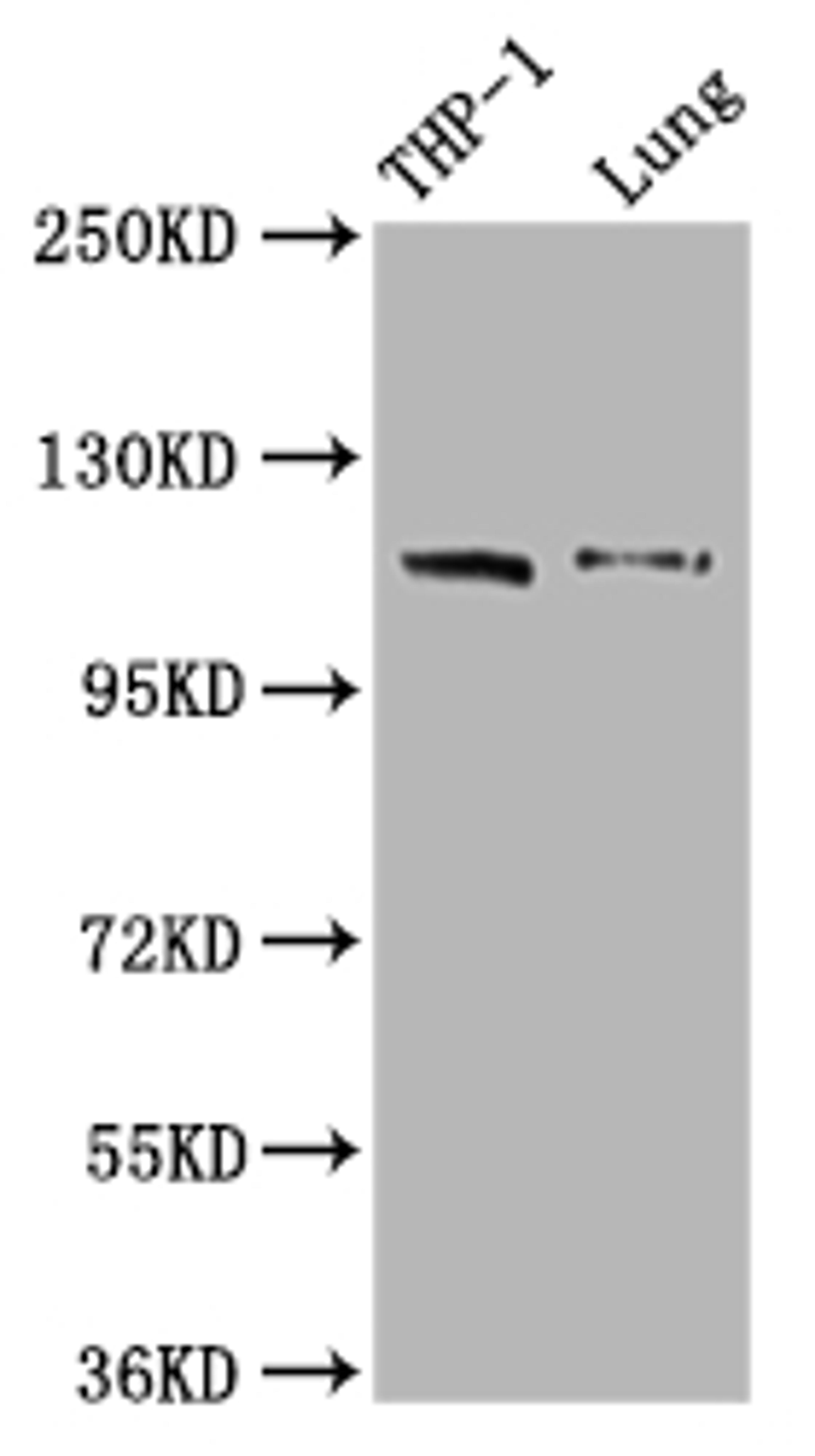 Western Blot. Positive WB detected in: THP-1 whole cell lysate, Mouse lung tissue. All lanes: MDA5 antibody at 1:2000. Secondary. Goat polyclonal to rabbit IgG at 1/50000 dilution. Predicted band size: 117, 26 kDa. Observed band size: 117 kDa. 
