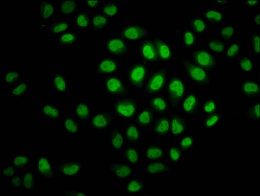 Immunofluorescence staining of Hela cells (treated with 30mM sodium crotonylate for 4h) with CSB-PA010403OA23crHU at 1:37.5, counter-stained with DAPI. The cells were fixed in 4% formaldehyde, permeabilized using 0.2% Triton X-100 and blocked in 10% normal Goat Serum. The cells were then incubated with the antibody overnight at 4&deg;C. The secondary antibody was Alexa Fluor 488-congugated AffiniPure Goat Anti-Rabbit IgG(H+L).
