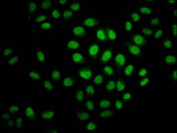 Immunofluorescence staining of Hela cells (treated with 30mM sodium crotonylate for 4h) with CSB-PA010403OA23crHU at 1:37.5, counter-stained with DAPI. The cells were fixed in 4% formaldehyde, permeabilized using 0.2% Triton X-100 and blocked in 10% normal Goat Serum. The cells were then incubated with the antibody overnight at 4°C. The secondary antibody was Alexa Fluor 488-congugated AffiniPure Goat Anti-Rabbit IgG(H+L).