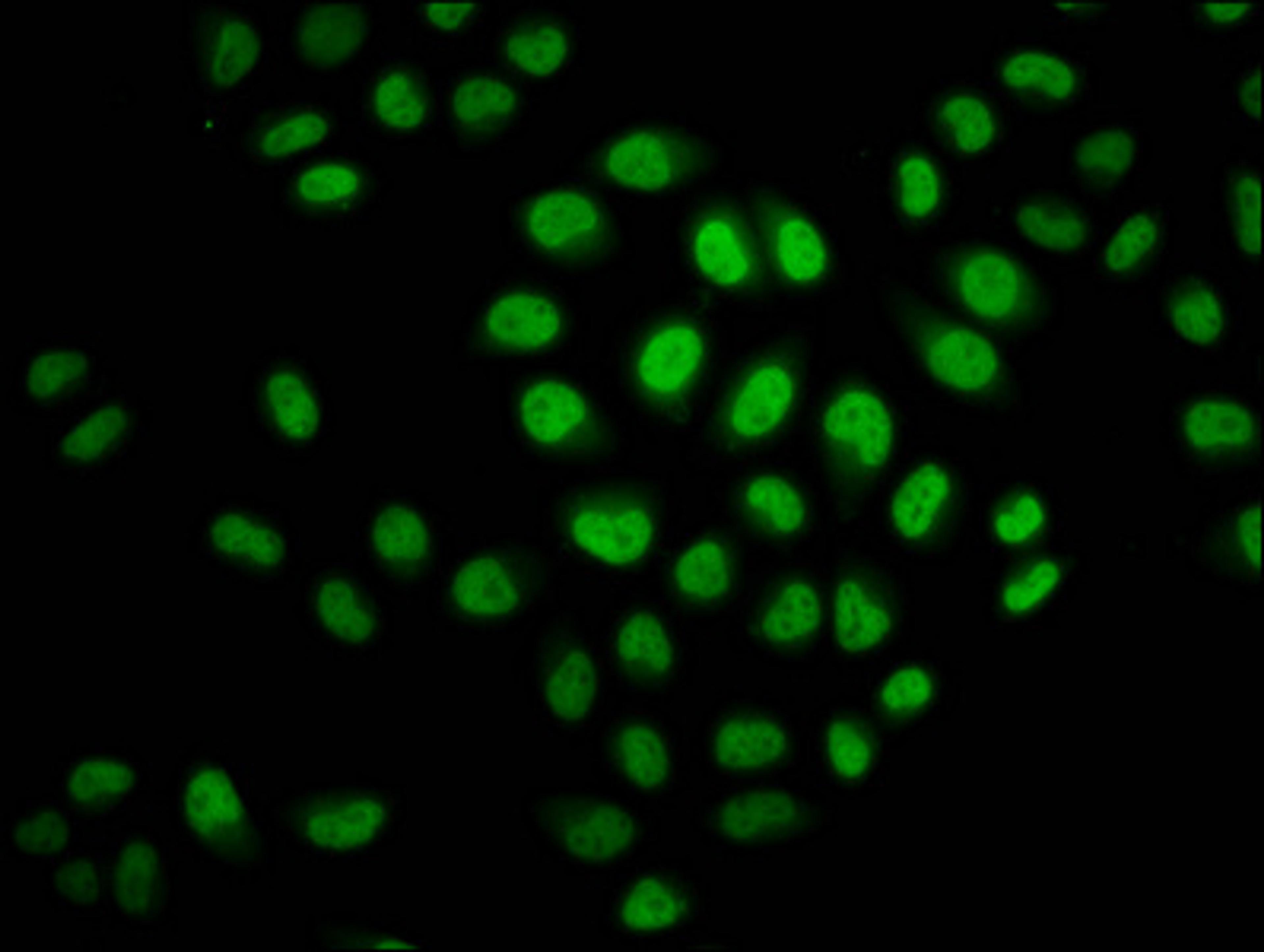 Immunofluorescence staining of Hela cells (treated with 30mM sodium crotonylate for 4h) with CSB-PA010403OA23crHU at 1:37.5, counter-stained with DAPI. The cells were fixed in 4% formaldehyde, permeabilized using 0.2% Triton X-100 and blocked in 10% normal Goat Serum. The cells were then incubated with the antibody overnight at 4°C. The secondary antibody was Alexa Fluor 488-congugated AffiniPure Goat Anti-Rabbit IgG(H+L).