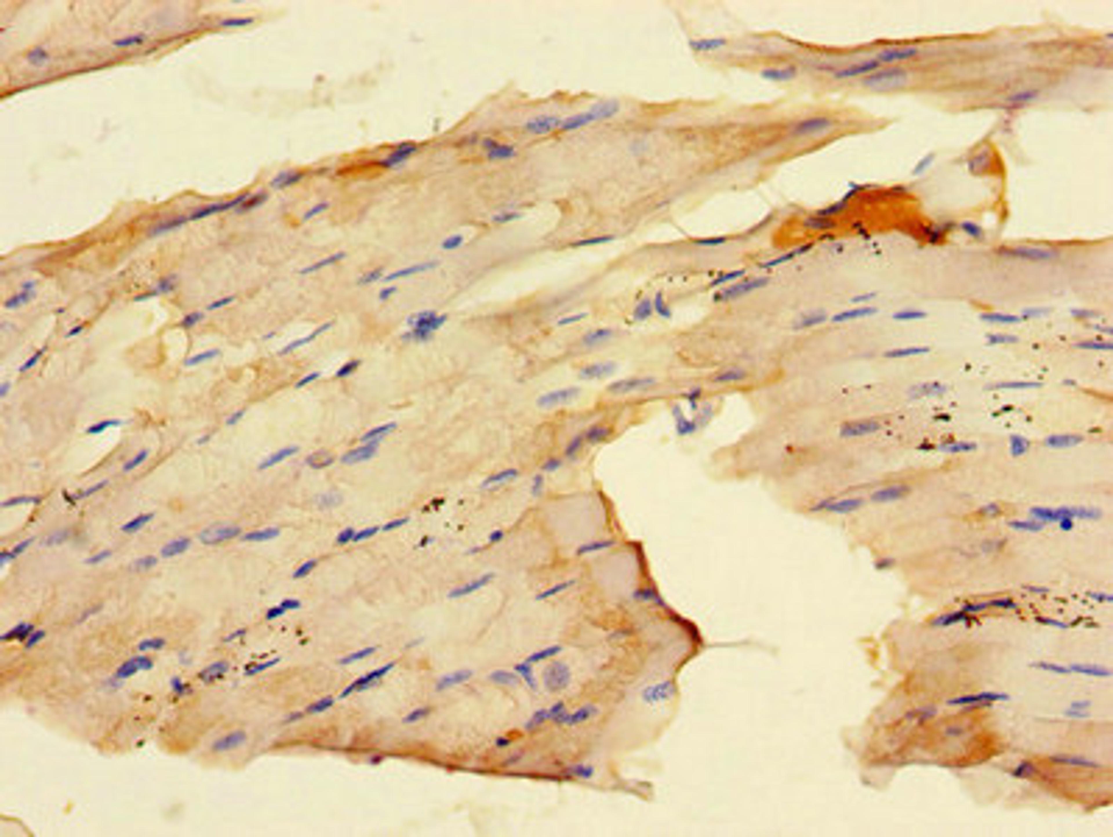 Immunohistochemistry of paraffin-embedded human skeletal muscle tissue using CSB-PA019179LA01HU at dilution of 1:100