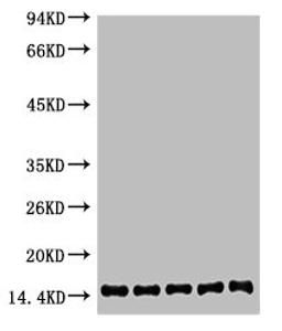 Western blot analysis of 1) Hela, 2) 3T3, 3) Raw264.7, 4) Rat Brain, 5) Rat Kidney, diluted at 1:2000.