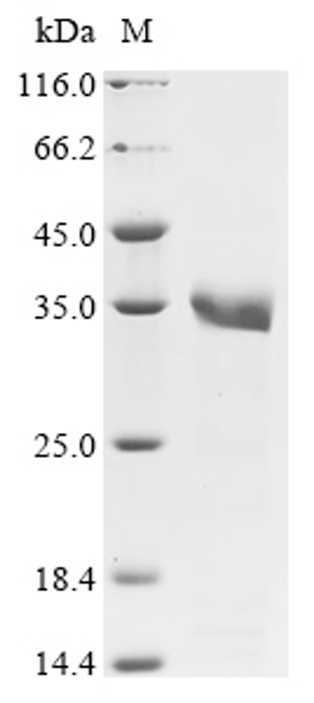 (Tris-Glycine gel) Discontinuous SDS-PAGE (reduced) with 5% enrichment gel and 15% separation gel.