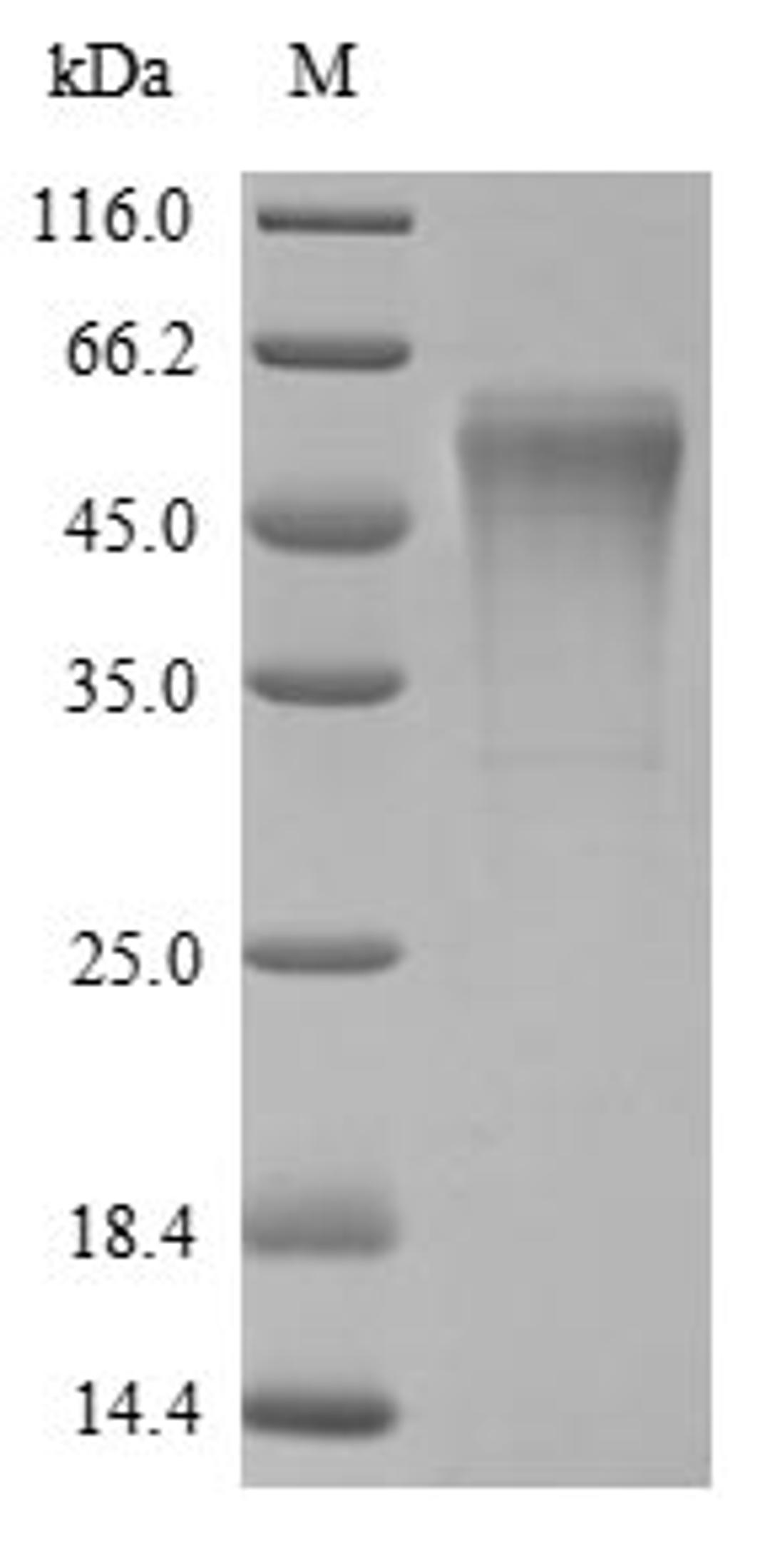 (Tris-Glycine gel) Discontinuous SDS-PAGE (reduced) with 5% enrichment gel and 15% separation gel.
