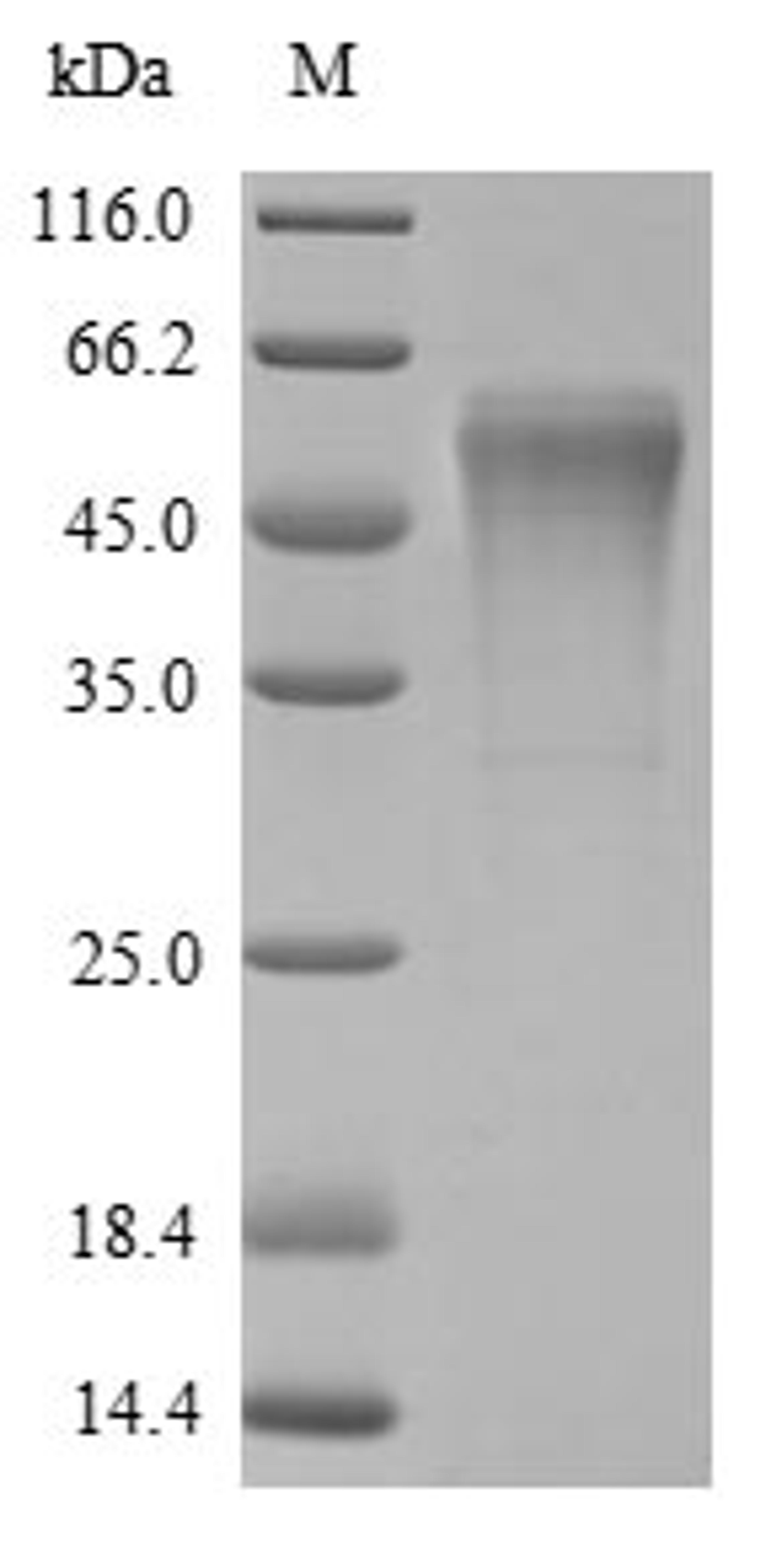 (Tris-Glycine gel) Discontinuous SDS-PAGE (reduced) with 5% enrichment gel and 15% separation gel.