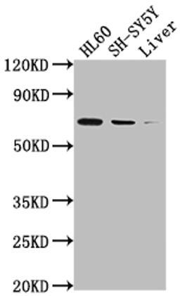 Western Blot. Positive WB detected in: HL60 whole cell lysate, SH-SY5Y whole cell lysate, Mouse liver tissue. All lanes: PTGS1 antibody at 1:2000. Secondary. Goat polyclonal to rabbit IgG at 1/50000 dilution. Predicted band size: 69, 65, 62, 57, 72, 73 kDa. Observed band size: 72 kDa. 