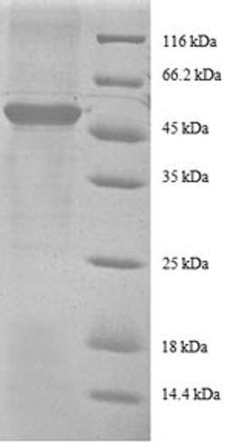 (Tris-Glycine gel) Discontinuous SDS-PAGE (reduced) with 5% enrichment gel and 15% separation gel.