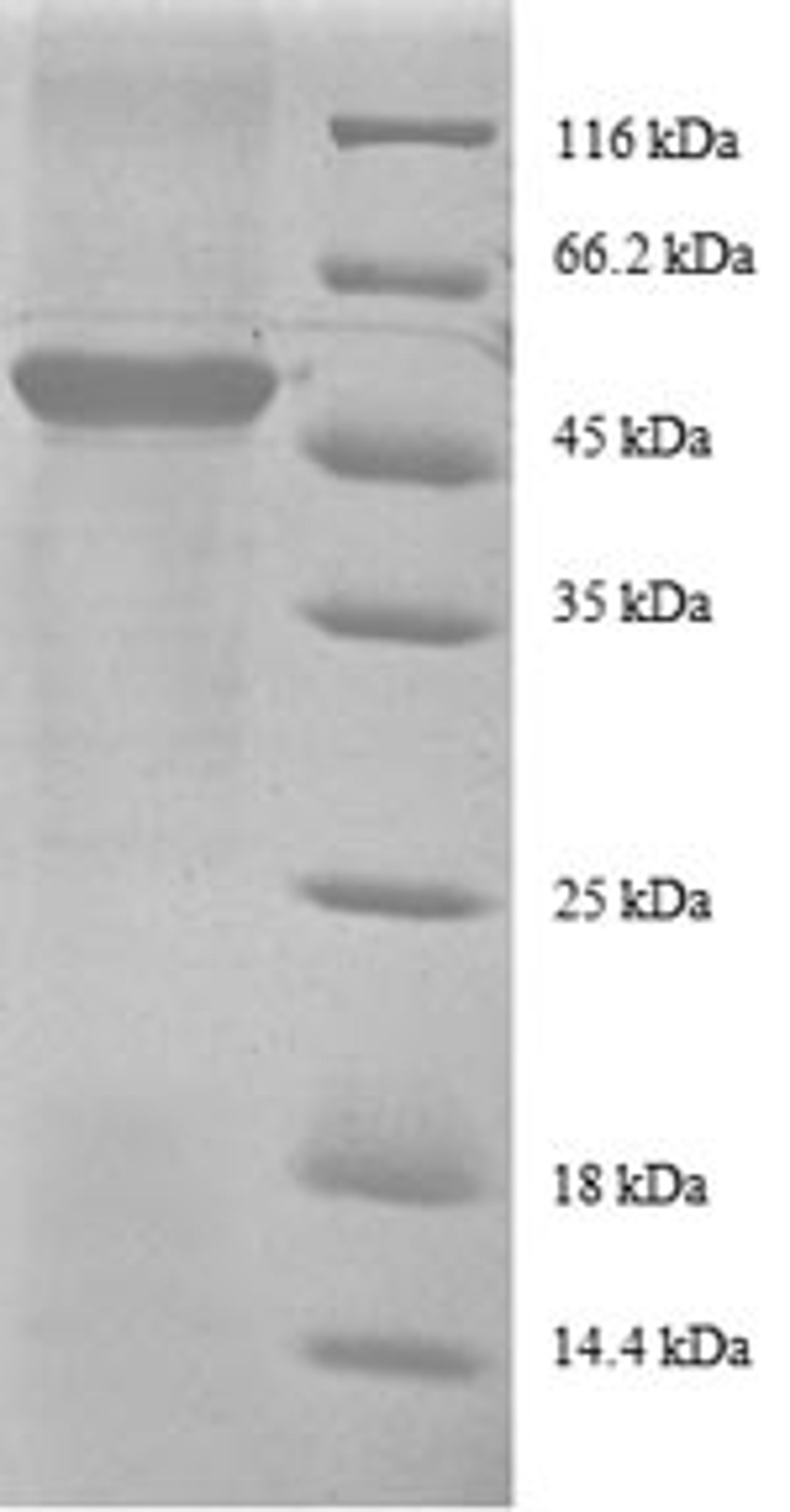 (Tris-Glycine gel) Discontinuous SDS-PAGE (reduced) with 5% enrichment gel and 15% separation gel.