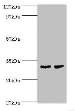 Western blot. All lanes: CA8 antibody at 4ug/ml. Lane 1: Mouse skeletal muscle tissue. Lane 2: Mouse liver tissue. Secondary. Goat polyclonal to rabbit IgG at 1/10000 dilution. Predicted band size: 33 kDa. Observed band size 33 kDa. 
