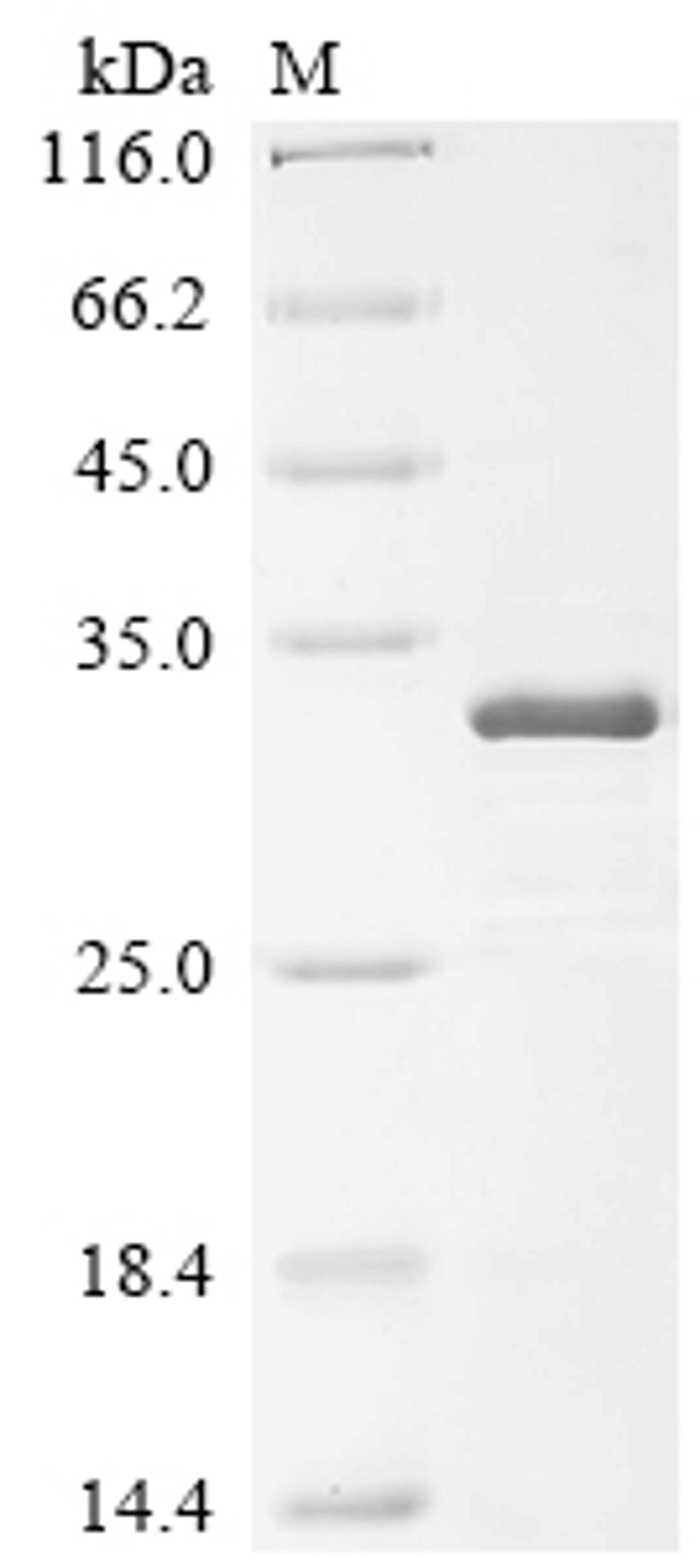 (Tris-Glycine gel) Discontinuous SDS-PAGE (reduced) with 5% enrichment gel and 15% separation gel.