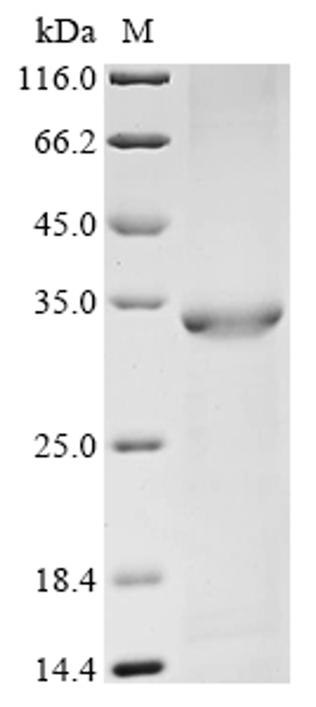 (Tris-Glycine gel) Discontinuous SDS-PAGE (reduced) with 5% enrichment gel and 15% separation gel.