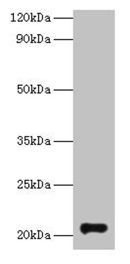 Western blot. All lanes: GM2A antibody at 2µg/ml + Rat kidney tissue. Secondary. Goat polyclonal to rabbit IgG at 1/10000 dilution. Predicted band size: 21 kDa. Observed band size: 21 kDa