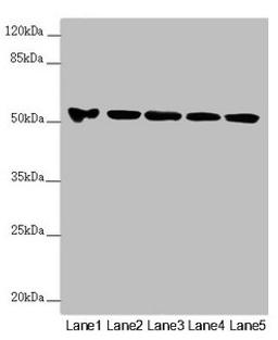 Western blot. All lanes: FOXRED1 antibody at 5.8µg/ml. Lane 1: A549 whole cell lysate. Lane 2: A431 whole cell lysate. Lane 3: Jurkat whole cell lysate. Lane 4: Hela whole cell lysate. Lane 5: HepG2 whole cell lysate. Secondary. Goat polyclonal to rabbit IgG at 1/10000 dilution. Predicted band size: 54, 31, 53 kDa. Observed band size: 54 kDa
