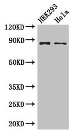 Western Blot. Positive WB detected in: HEK293 whole cell lysate, Hela whole cell lysate. All lanes: MLH1 antibody at 3ug/ml. Secondary. Goat polyclonal to rabbit IgG at 1/50000 dilution. Predicted band size: 85, 59, 74 kDa. Observed band size: 85 kDa. 