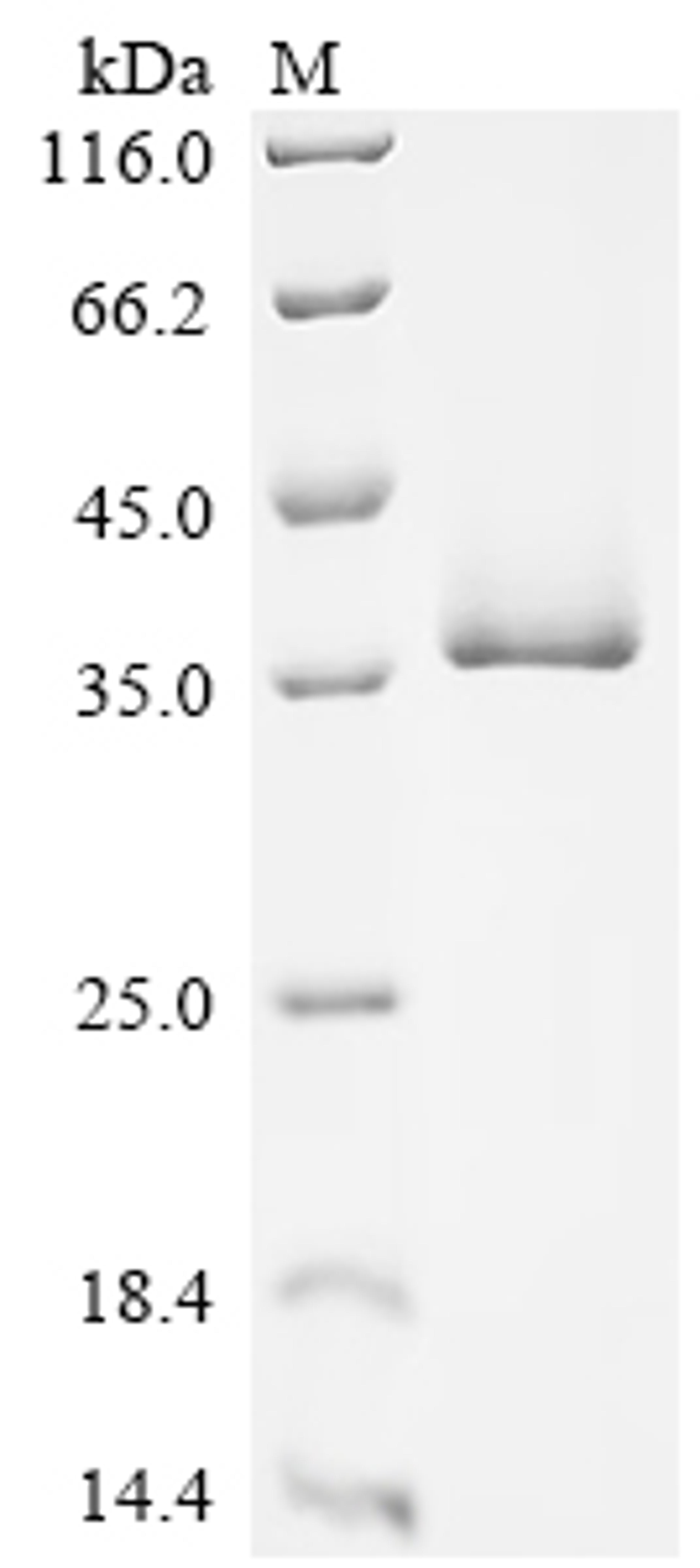 (Tris-Glycine gel) Discontinuous SDS-PAGE (reduced) with 5% enrichment gel and 15% separation gel.