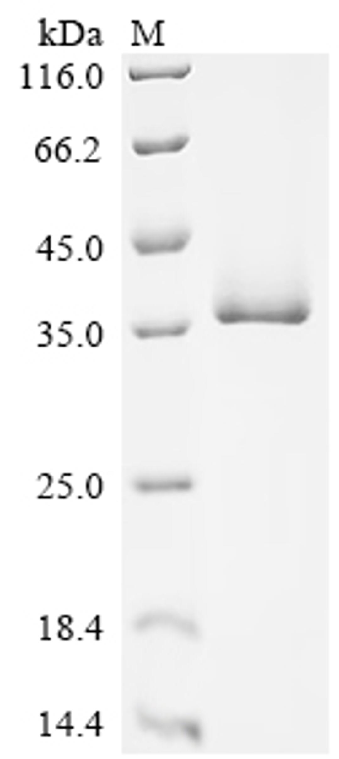 (Tris-Glycine gel) Discontinuous SDS-PAGE (reduced) with 5% enrichment gel and 15% separation gel.