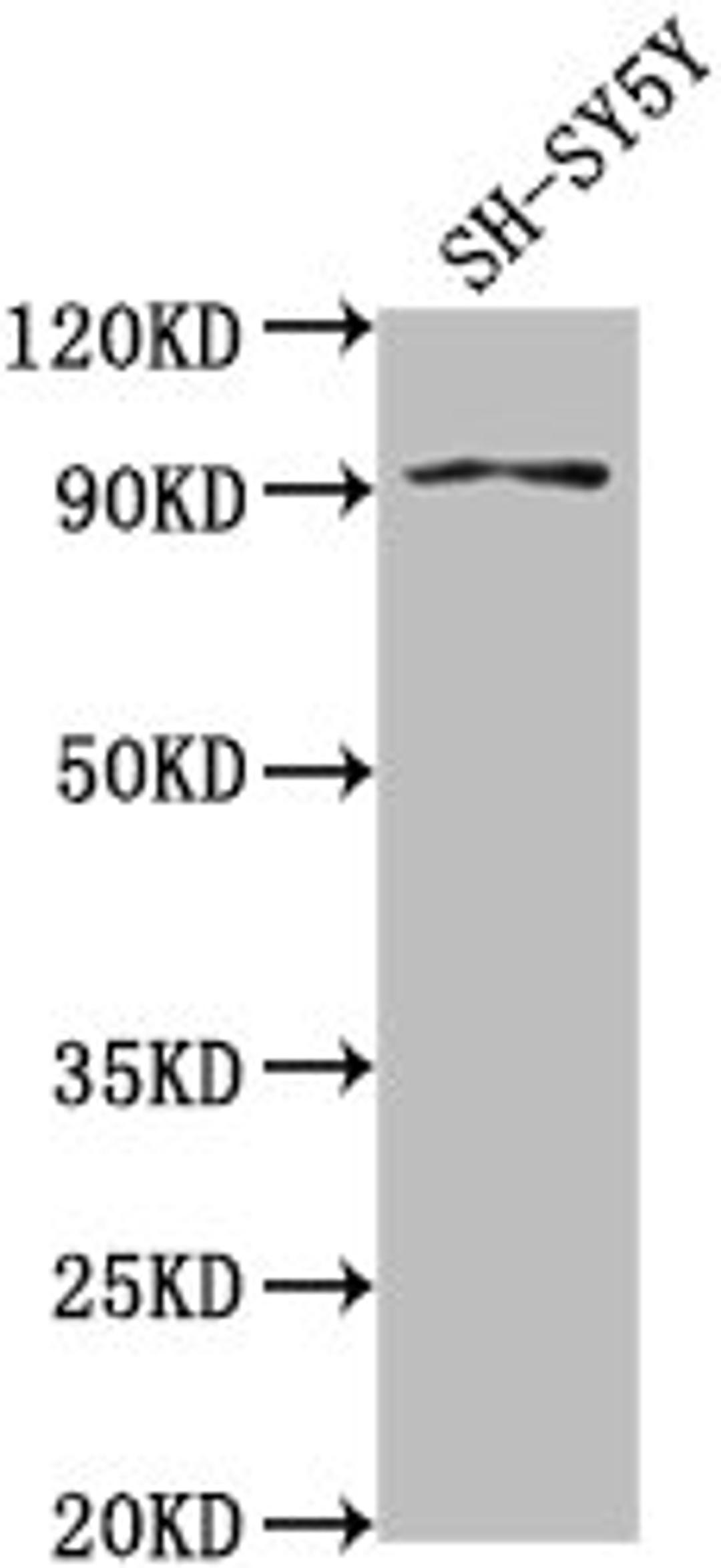 Western Blot. Positive WB detected in: SH-SY5Y whole cell lysate. All lanes: GPLD1 antibody at 1:2000. Secondary. Goat polyclonal to rabbit IgG at 1/50000 dilution. Predicted band size: 93, 20 kDa. Observed band size: 93 kDa. 