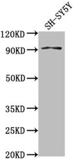 Western Blot. Positive WB detected in: SH-SY5Y whole cell lysate. All lanes: GPLD1 antibody at 1:2000. Secondary. Goat polyclonal to rabbit IgG at 1/50000 dilution. Predicted band size: 93, 20 kDa. Observed band size: 93 kDa. 