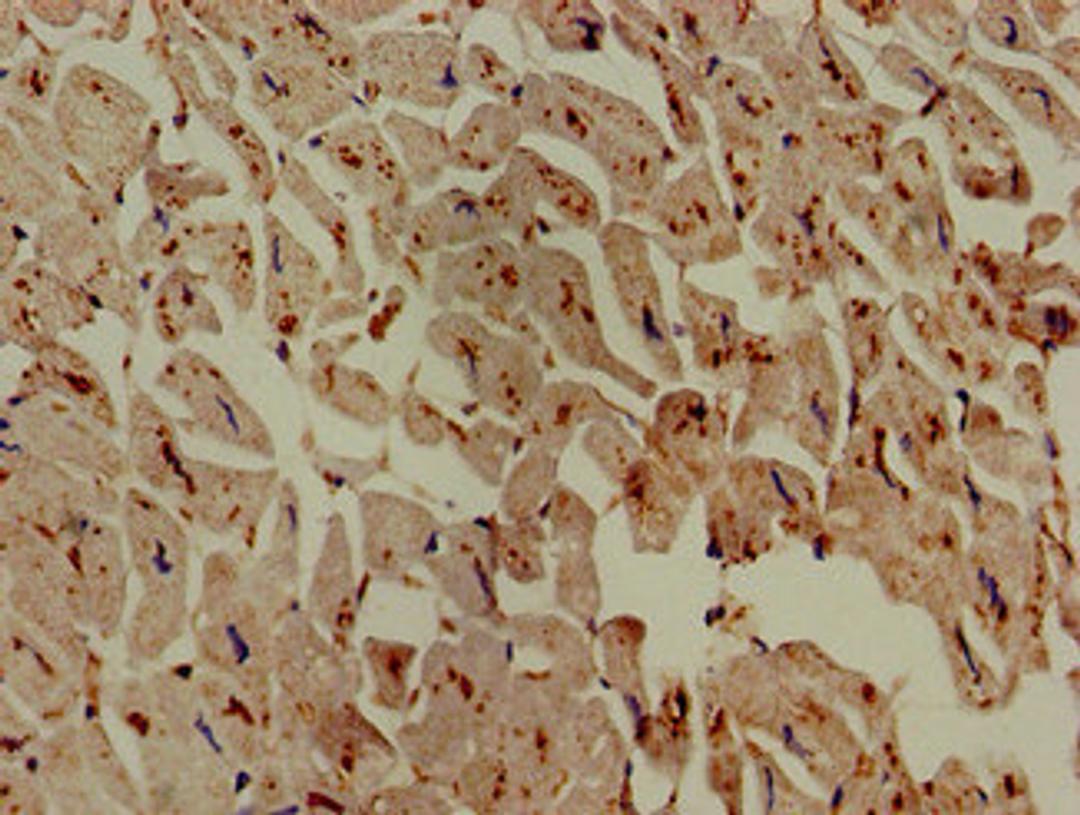 Immunohistochemistry of paraffin-embedded human heart tissue using CSB-PA619774LA01HU at dilution of 1:100