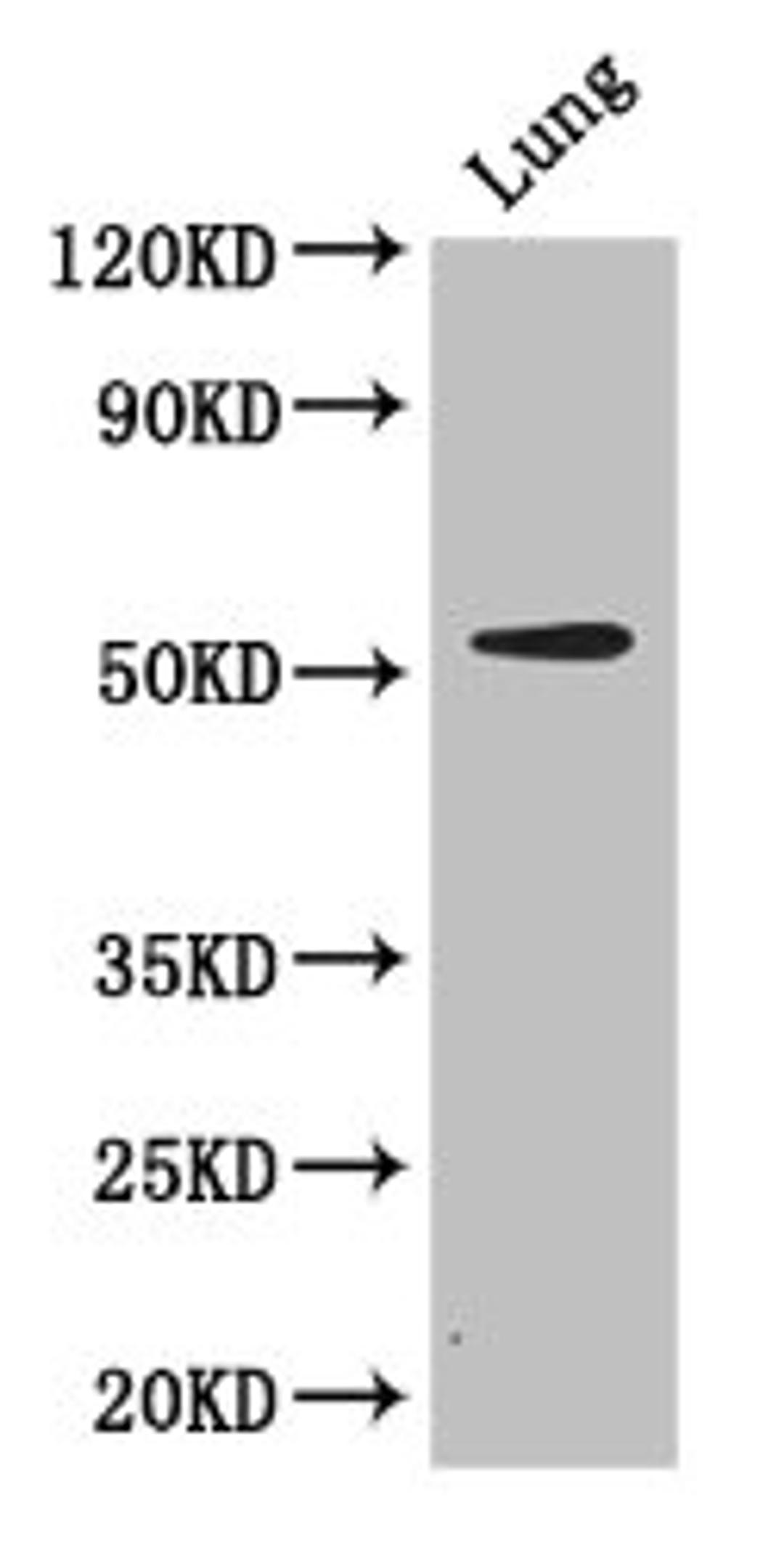 Western Blot. Positive WB detected in: Mouse lung tissue. All lanes: CORO1A antibody at 2.7ug/ml. Secondary. Goat polyclonal to rabbit IgG at 1/50000 dilution. Predicted band size: 52 kDa. Observed band size: 52 kDa.
