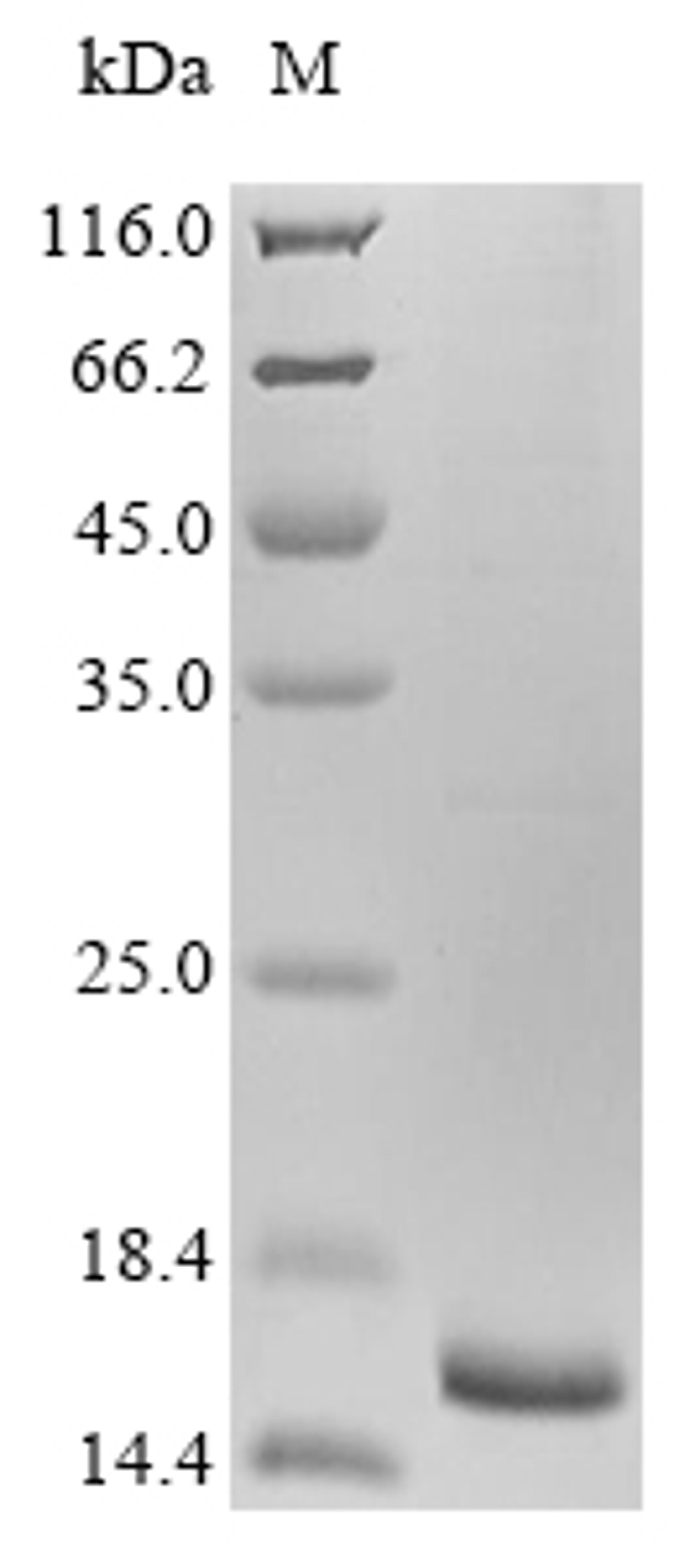 (Tris-Glycine gel) Discontinuous SDS-PAGE (reduced) with 5% enrichment gel and 15% separation gel.