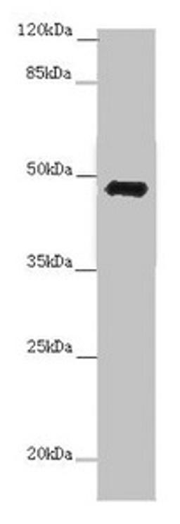 Western blot. All lanes: E2F1 antibody at 7 µg/ml + 3T3 whole cell lysate. Secondary. Goat polyclonal to rabbit IgG at 1/10000 dilution. Predicted band size: 47 kDa. Observed band size: 47 kDa