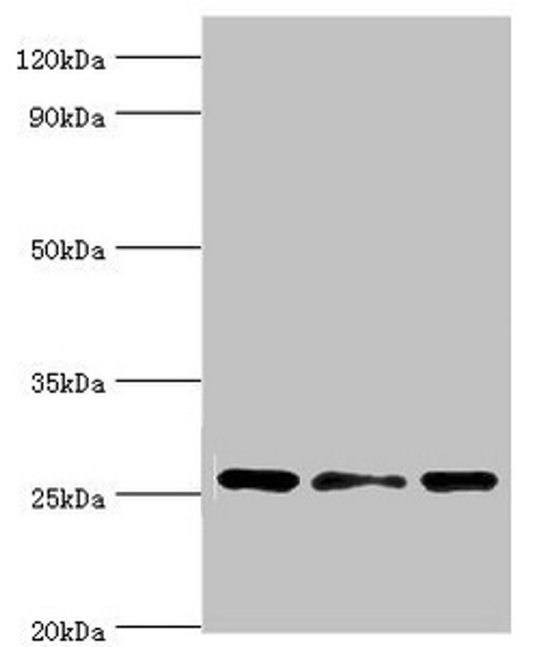 Western blot. All lanes: Chloride intracellular channel protein 1 antibody at 4ug/ml. Lane 1: Hela whole cell lysate. Lane 2: Jurkat whole cell lysate. Lane 3: MCF-7 whole cell lysate. Secondary. Goat polyclonal to rabbit IgG at 1/10000 dilution. Predicted band size: 27 kDa. Observed band size: 27 kDa. 