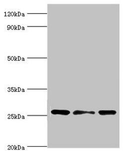 Western blot. All lanes: Chloride intracellular channel protein 1 antibody at 4ug/ml. Lane 1: Hela whole cell lysate. Lane 2: Jurkat whole cell lysate. Lane 3: MCF-7 whole cell lysate. Secondary. Goat polyclonal to rabbit IgG at 1/10000 dilution. Predicted band size: 27 kDa. Observed band size: 27 kDa. 