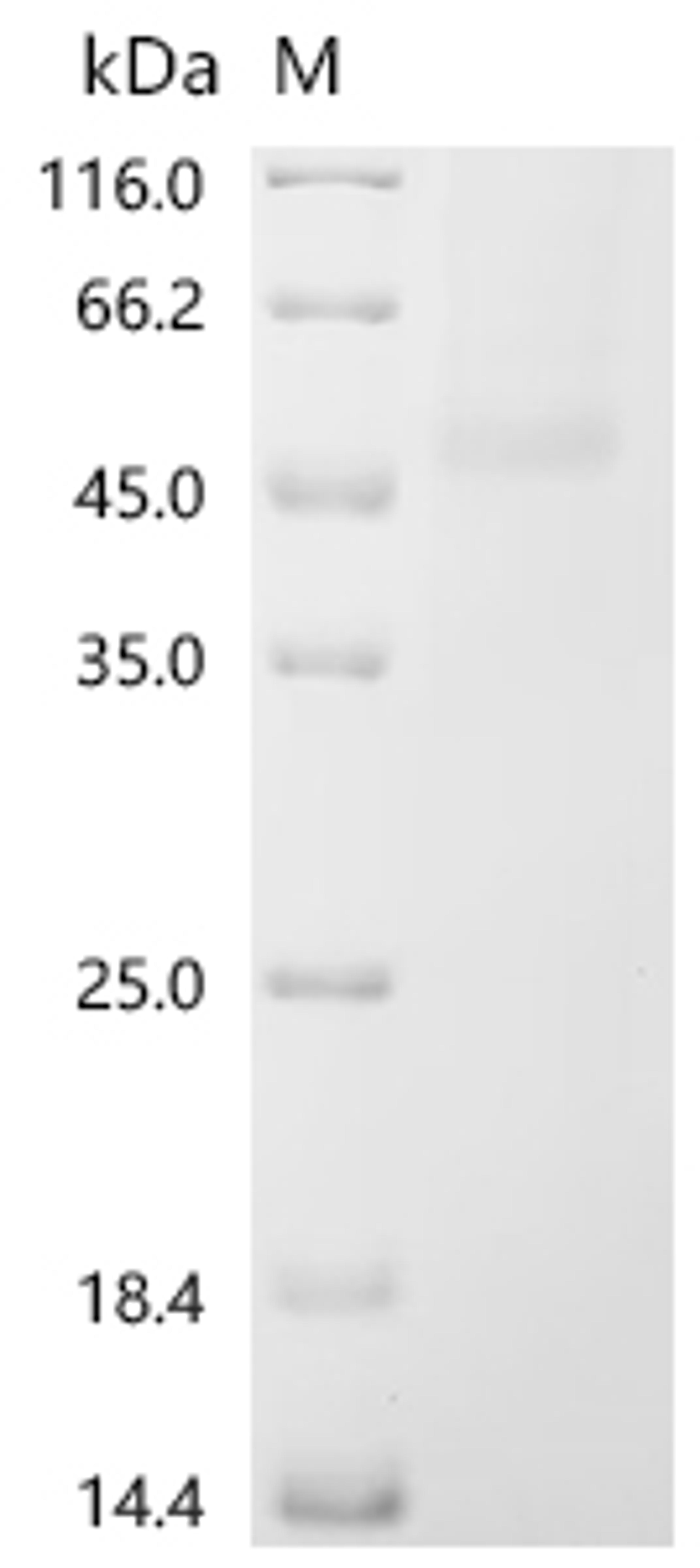 (Tris-Glycine gel) Discontinuous SDS-PAGE (reduced) with 5% enrichment gel and 15% separation gel.