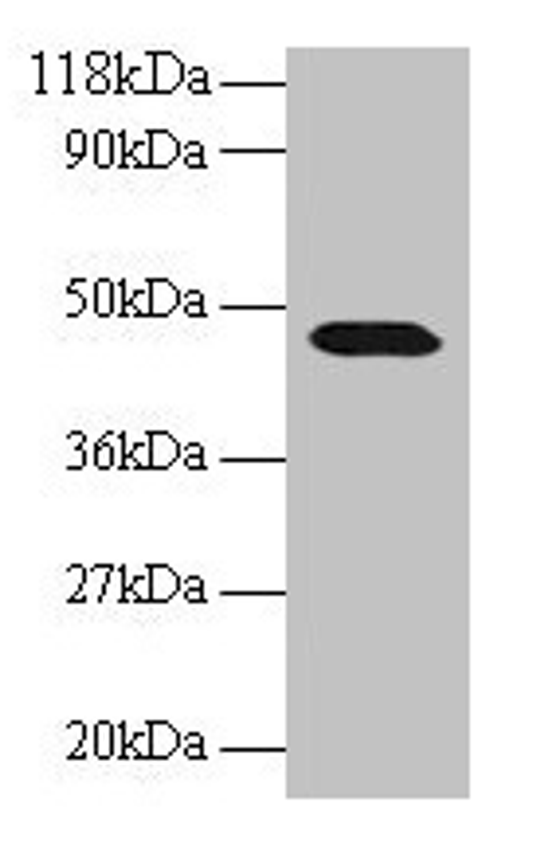 Western blot. All lanes: CNPY2 antibody at 2µg/ml + 293T whole cell lysate. Secondary. Goat polyclonal to rabbit IgG at 1/15000 dilution. Predicted band size: 21, 10 kDa. Observed band size: 47 kDa