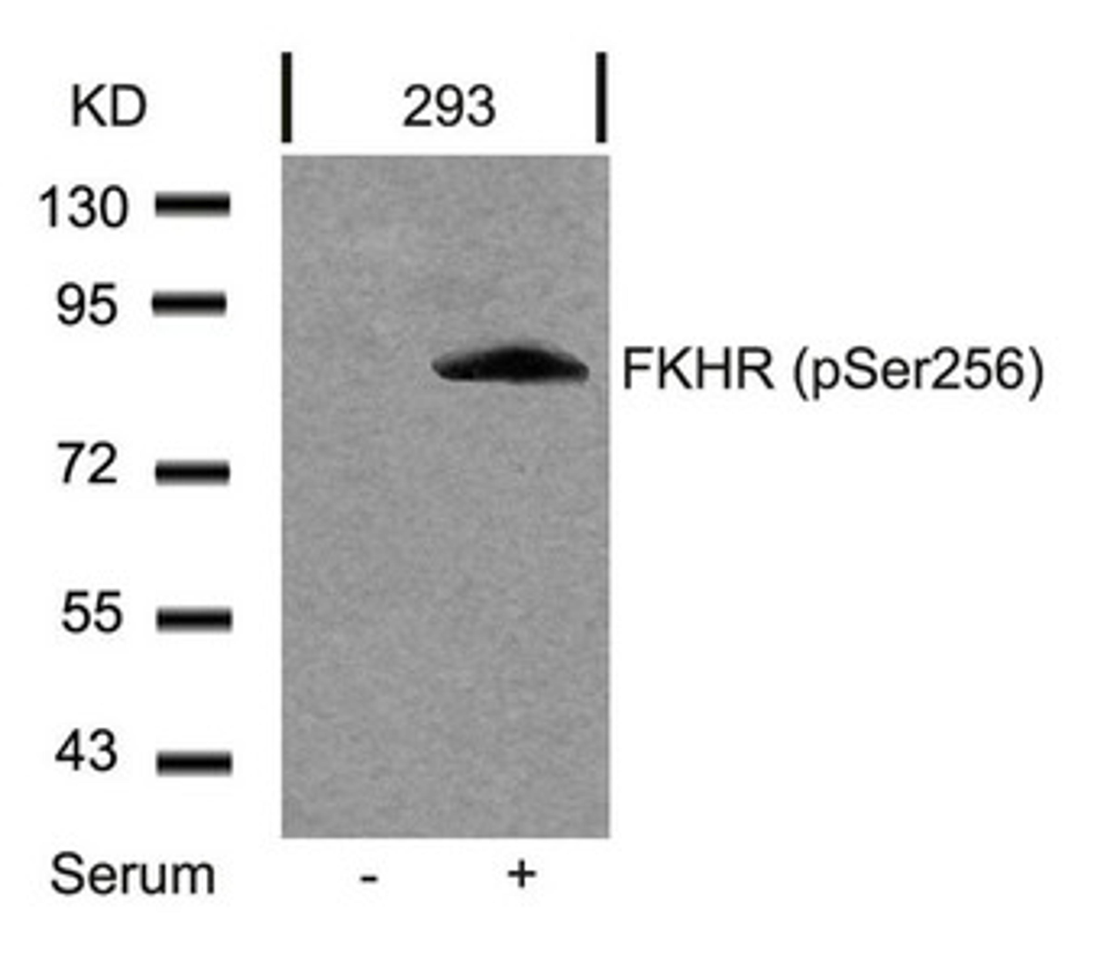 Western blot analysis of extracts from 293 cells untreated or treated with serum using FKHR(Phospho-Ser256) Antibody.