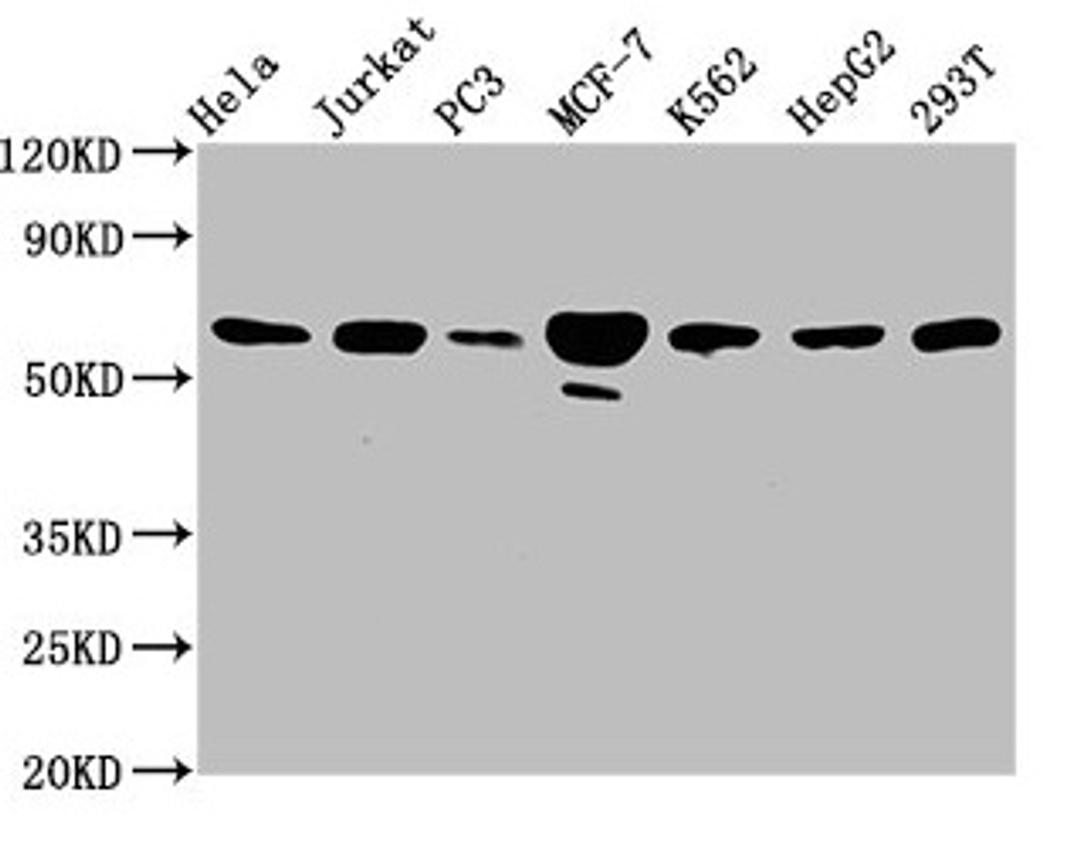 Western Blot. Positive WB detected in: Hela whole cell lysate, Jurkat whole cell lysate, PC-3 whole cell lysate, MCF-7 whole cell lysate, K562 whole cell lysate, HepG2 whole cell lysate, 293T whole cell lysate. All lanes: FKBP4 antibody at 3.3µg/ml. Secondary. Goat polyclonal to rabbit IgG at 1/50000 dilution. Predicted band size: 52 kDa. Observed band size: 59 kDa