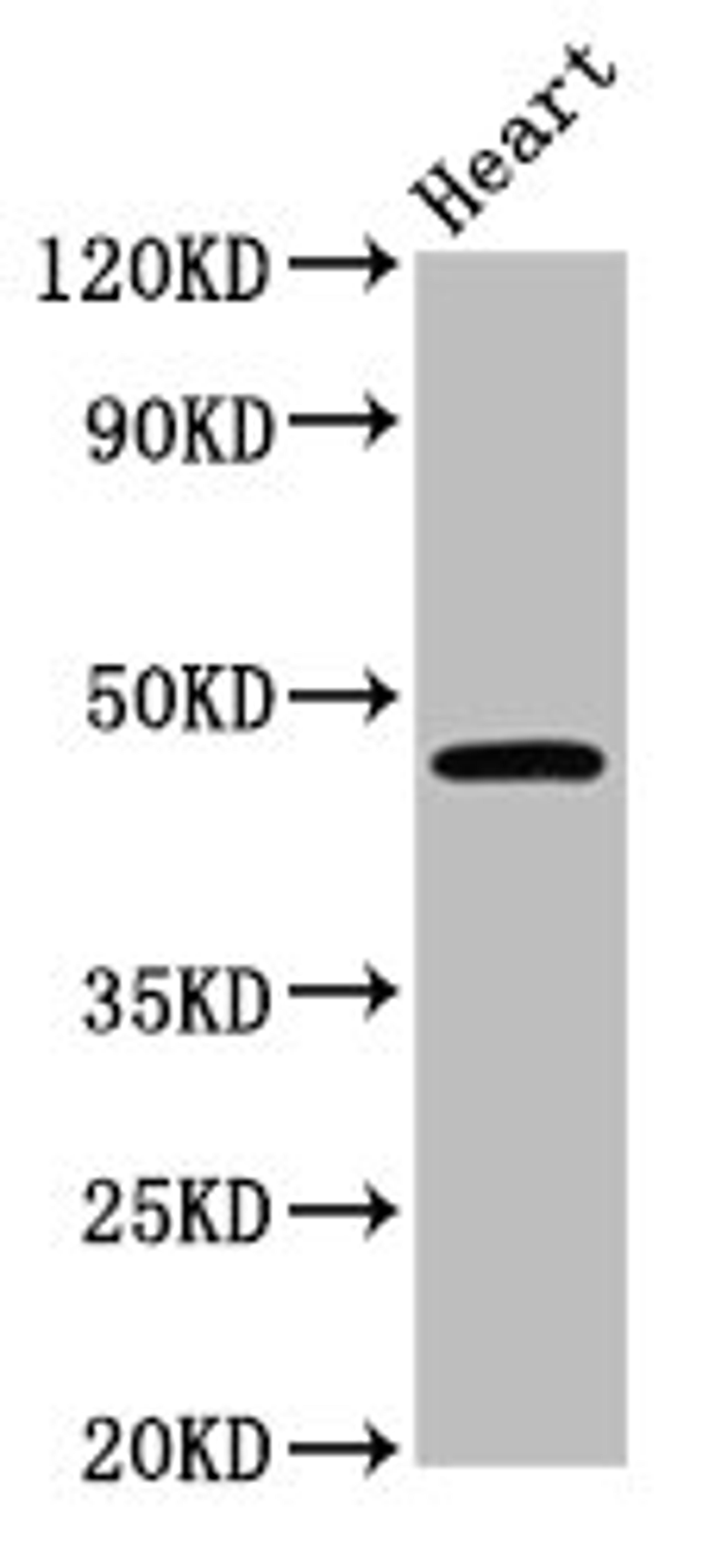 Western Blot. Positive WB detected in: Mouse heart tissue. All lanes: CERS3 antibody at 3.6ug/ml. Secondary. Goat polyclonal to rabbit IgG at 1/50000 dilution. Predicted band size: 47 kDa. Observed band size: 47 kDa. 