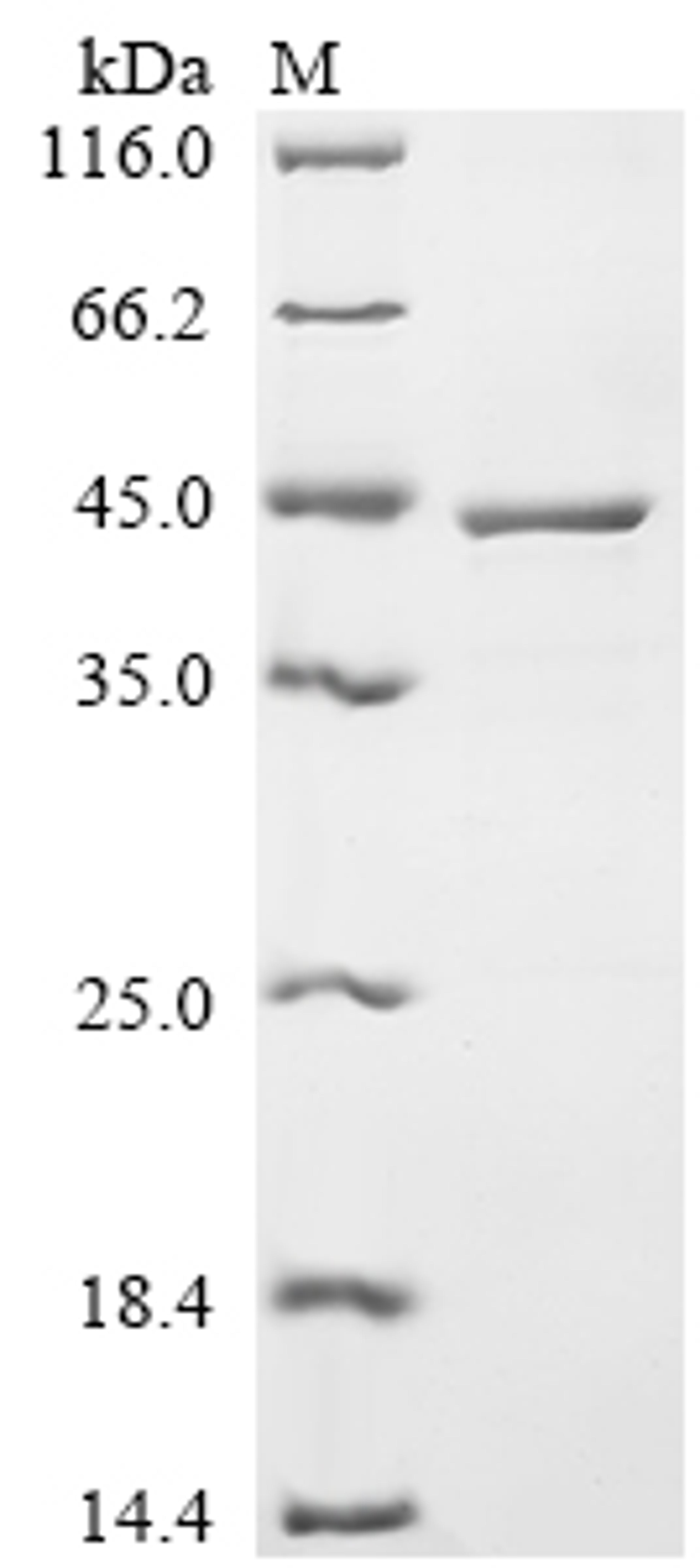 (Tris-Glycine gel) Discontinuous SDS-PAGE (reduced) with 5% enrichment gel and 15% separation gel.