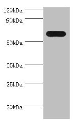 Western blot. All lanes: PAX7 antibody at 4ug/ml + 293T whole cell lysate. Secondary. Goat polyclonal to rabbit IgG at 1/10000 dilution. Predicted band size: 56, 57 kDa. Observed band size: 56 kDa. 