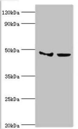 Western blot. All lanes: Histone-lysine N-methyltransferase SMYD3 antibody at 3ug/ml. Lane 1: Hela whole cell lysate. Lane 2: HepG2 whole cell lysate. Secondary. Goat polyclonal to rabbit IgG at 1/10000 dilution. Predicted band size: 50, 30, 43 kDa. Observed band size: 50 kDa. 