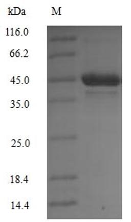 (Tris-Glycine gel) Discontinuous SDS-PAGE (reduced) with 5% enrichment gel and 15% separation gel.
