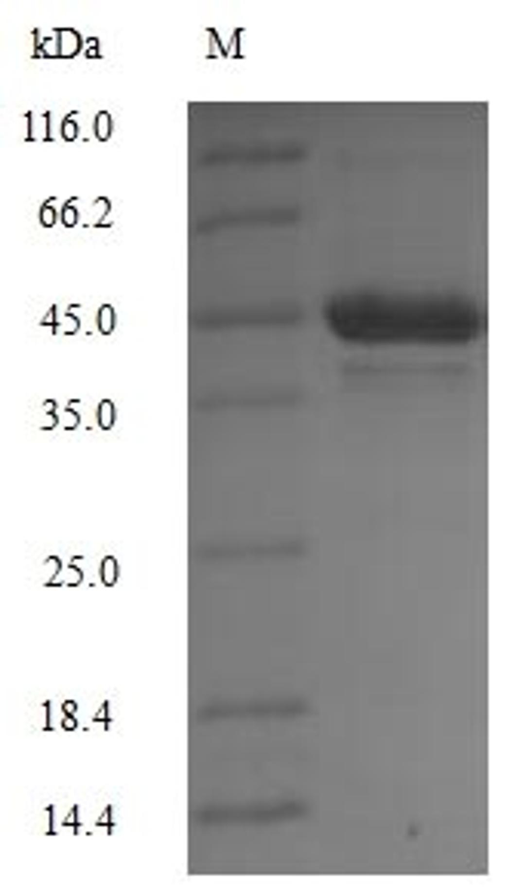 (Tris-Glycine gel) Discontinuous SDS-PAGE (reduced) with 5% enrichment gel and 15% separation gel.