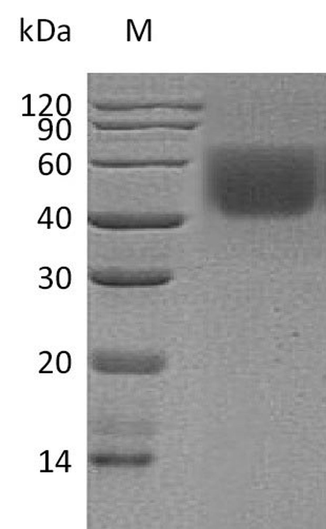 (Tris-Glycine gel) Discontinuous SDS-PAGE (reduced) with 5% enrichment gel and 15% separation gel.