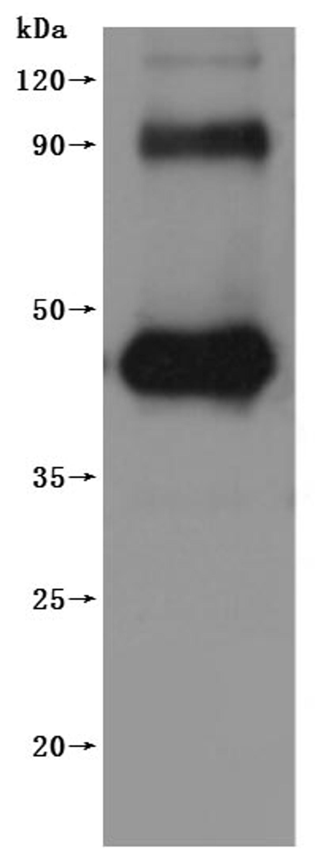 CSB-MP882153HU is detected by Mouse anti-6*His monoclonal antibody.