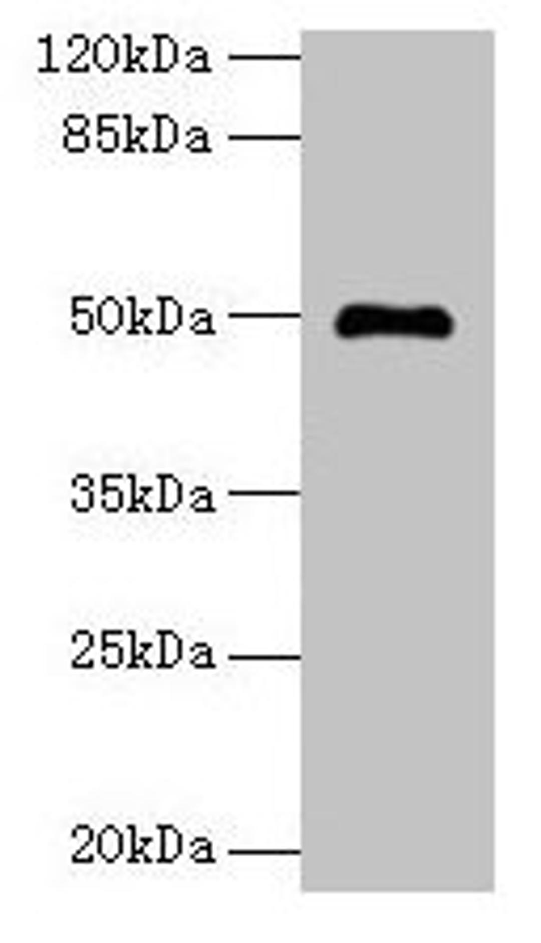 Western blot. All lanes: ADAL antibody at 6µg/ml + Mouse kidney tissue. Secondary. Goat polyclonal to rabbit IgG at 1/10000 dilution. Predicted band size: 41, 31, 38 kDa. Observed band size: 50 kDa