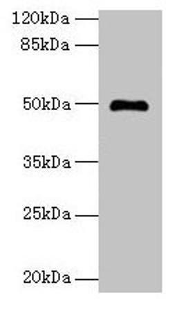 Western blot. All lanes: ADAL antibody at 6µg/ml + Mouse kidney tissue. Secondary. Goat polyclonal to rabbit IgG at 1/10000 dilution. Predicted band size: 41, 31, 38 kDa. Observed band size: 50 kDa