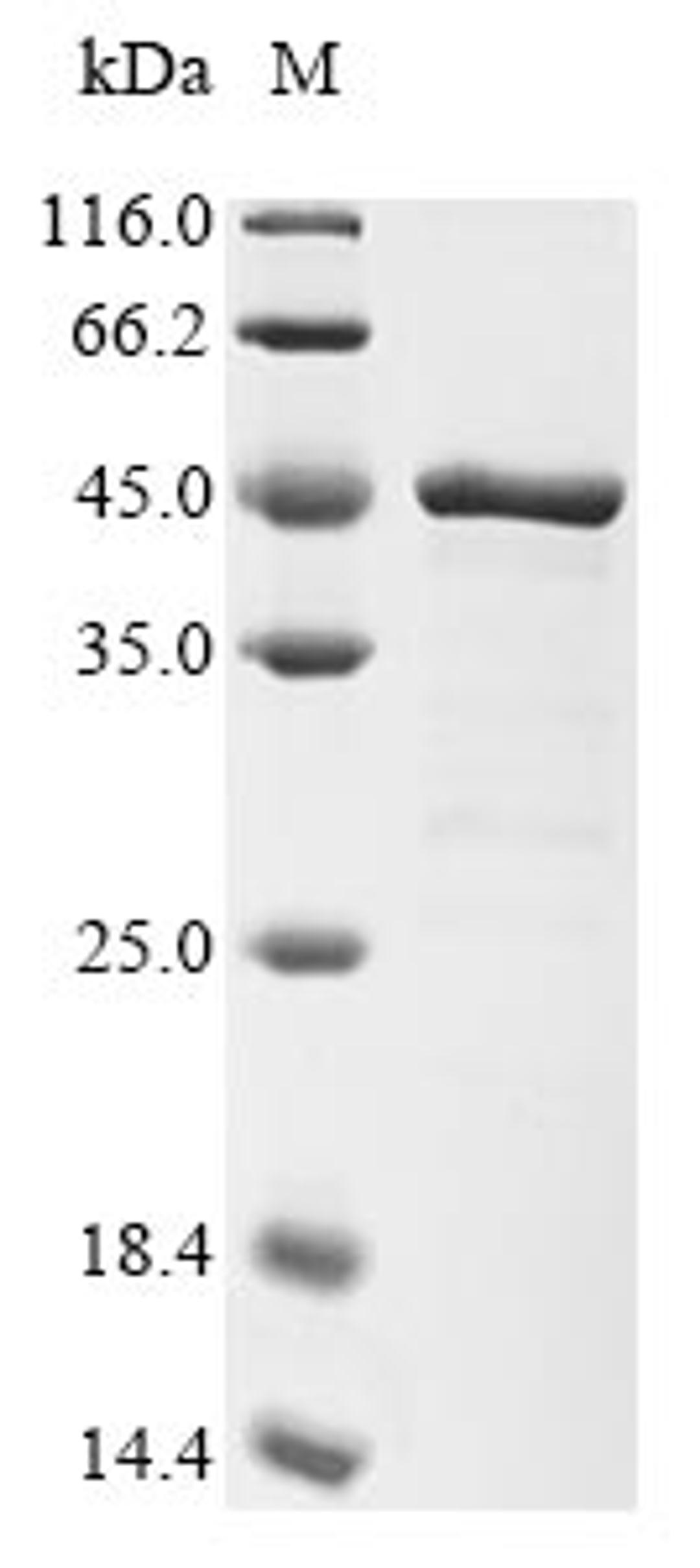 (Tris-Glycine gel) Discontinuous SDS-PAGE (reduced) with 5% enrichment gel and 15% separation gel.