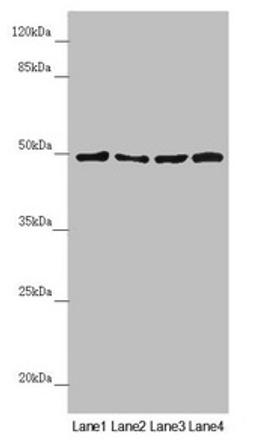 Western blot. All lanes: AP1M1 antibody at 1.38µg/ml. Lane 1: A375 whole cell lysate. Lane 2: Jurkat whole cell lysate. Lane 3: Hela whole cell lysate. Lane 4: HepG2 whole cell lysate. Secondary. Goat polyclonal to rabbit IgG at 1/10000 dilution. Predicted band size: 49, 50 kDa. Observed band size: 49 kDa