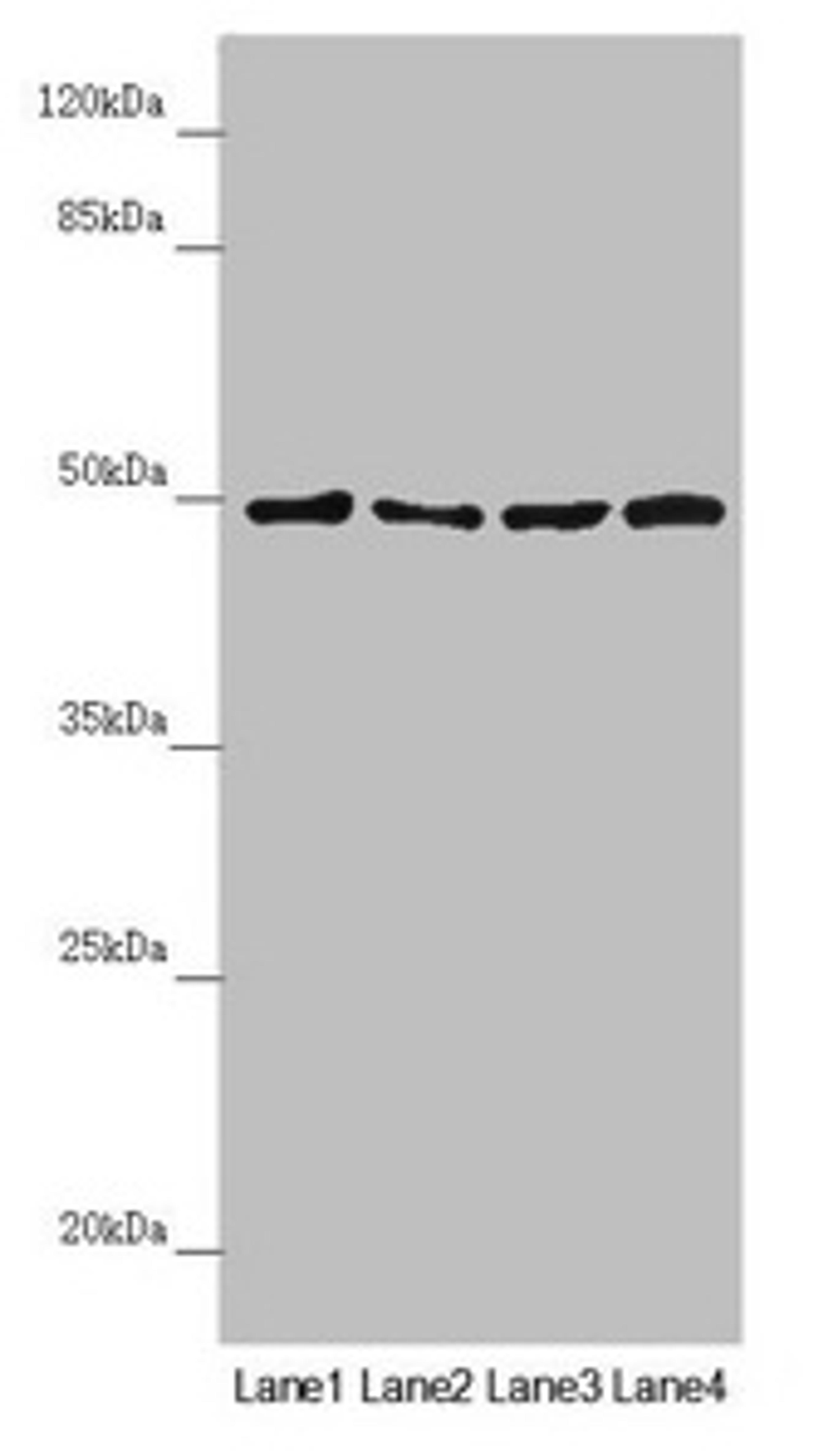 Western blot. All lanes: AP1M1 antibody at 1.38µg/ml. Lane 1: A375 whole cell lysate. Lane 2: Jurkat whole cell lysate. Lane 3: Hela whole cell lysate. Lane 4: HepG2 whole cell lysate. Secondary. Goat polyclonal to rabbit IgG at 1/10000 dilution. Predicted band size: 49, 50 kDa. Observed band size: 49 kDa