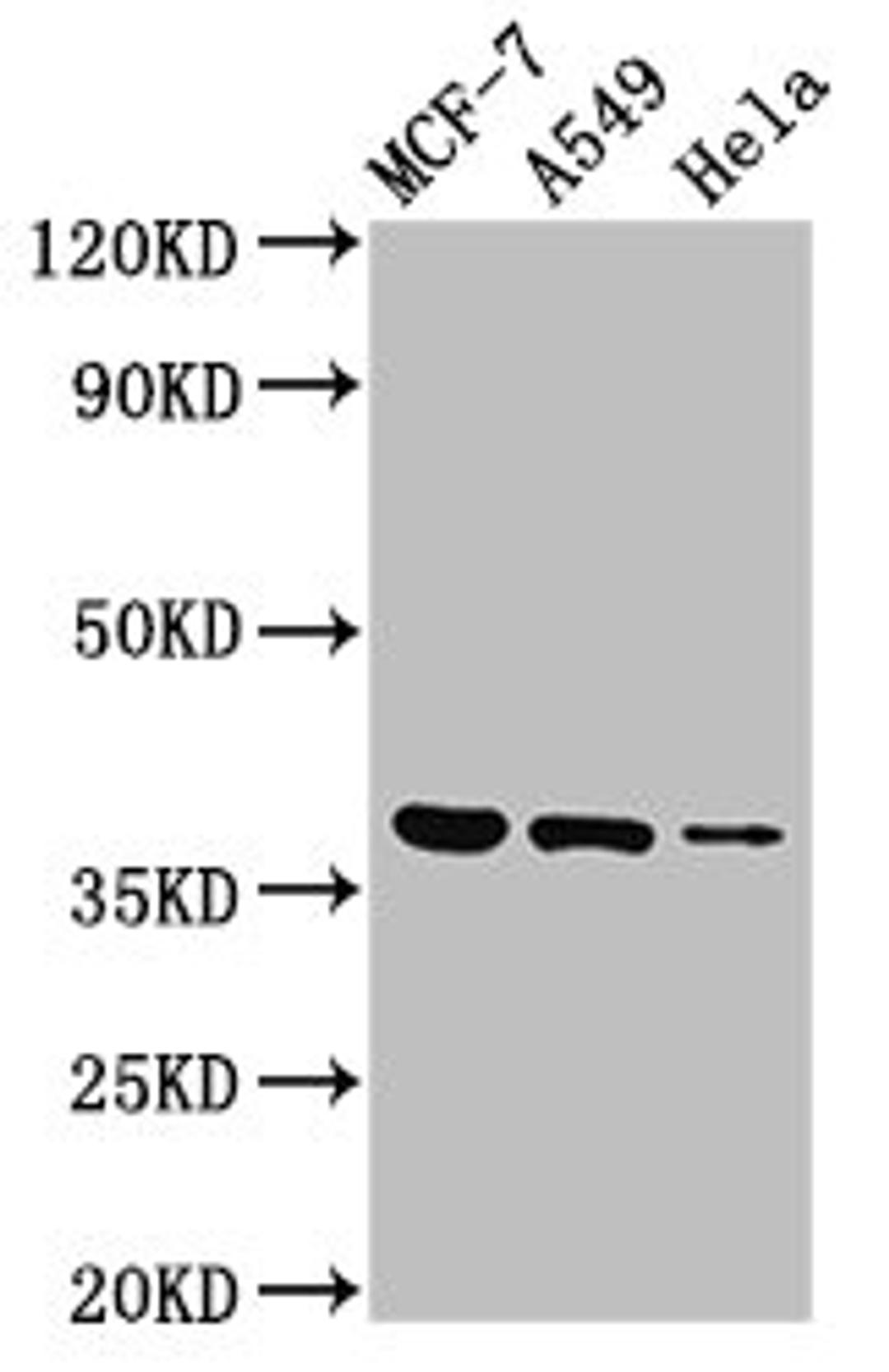 Western Blot. Positive WB detected in: MCF-7 whole cell lysate, A549 whole cell lysate, Hela whole cell lysate. All lanes: TMEM59 antibody at 3µg/ml. Secondary. Goat polyclonal to rabbit IgG at 1/50000 dilution. Predicted band size: 37 kDa. Observed band size: 37 kDa