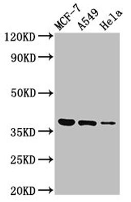 Western Blot. Positive WB detected in: MCF-7 whole cell lysate, A549 whole cell lysate, Hela whole cell lysate. All lanes: TMEM59 antibody at 3µg/ml. Secondary. Goat polyclonal to rabbit IgG at 1/50000 dilution. Predicted band size: 37 kDa. Observed band size: 37 kDa
